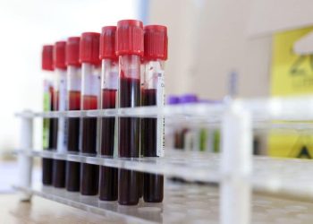 Constanța: Se pot face programări pentru donare de sânge