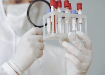 COVID-19: A scăzut rata de incidență în Constanța