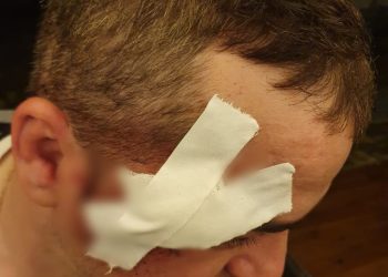 EXCLUSIV: Doi clienți au fost bătuți de patronul unui restaurant din Costinești