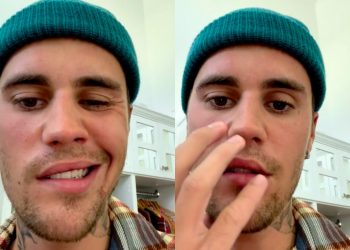 Justin Bieber își anulează spectacolele după ce i-a rămas paralizată jumătate din față