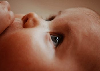 Boala obrajilor pălmuiți 