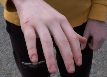 O ceartă între copii, transformată într-o BĂTAIE în toată regula, la Kogălniceanu