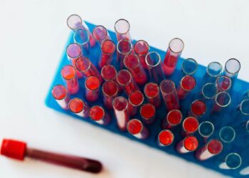 România are, totuși, sânge în vene